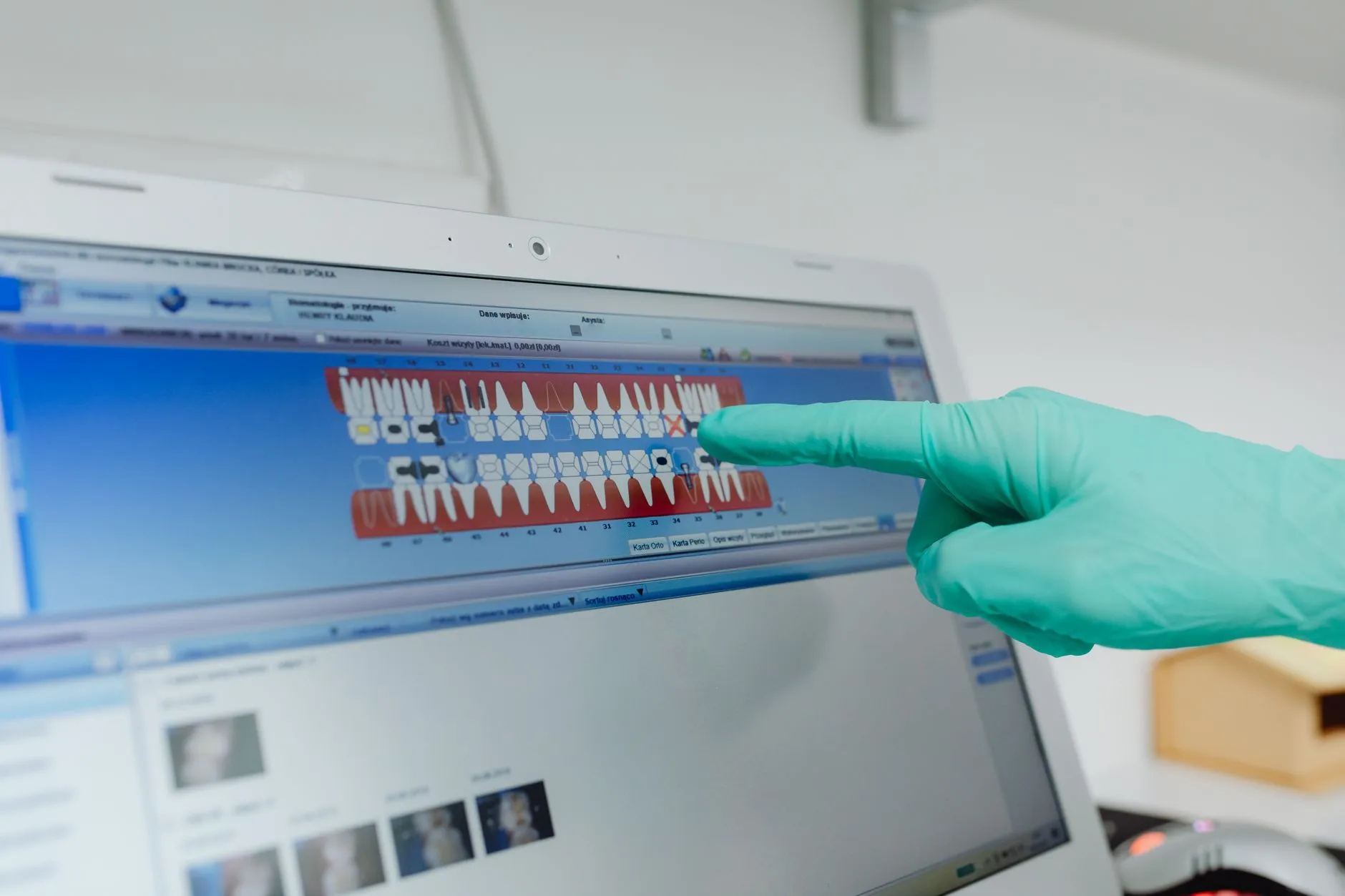 A clinician pointing at patient software on a monitor.