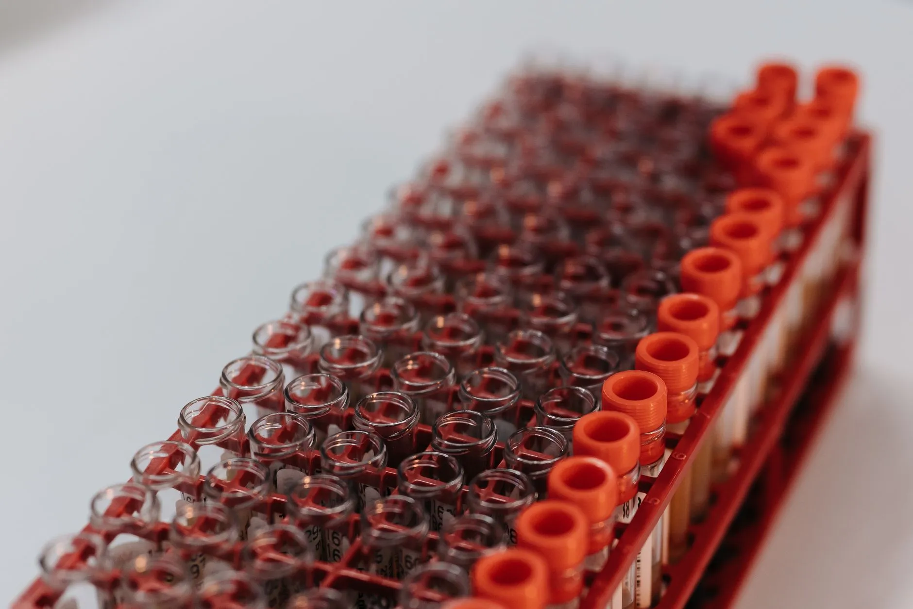 Test tubes in a laboratory rack.